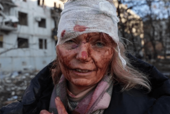 KRVAVA VOJNA V UKRAJINI